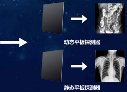 動態DR的兩塊平板怎么使用:根據臨床場景實現專板專用